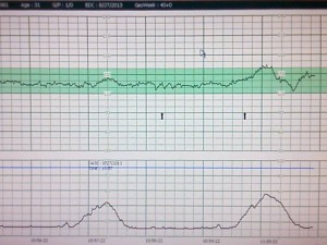 Heartbeat and Contraction Monitor